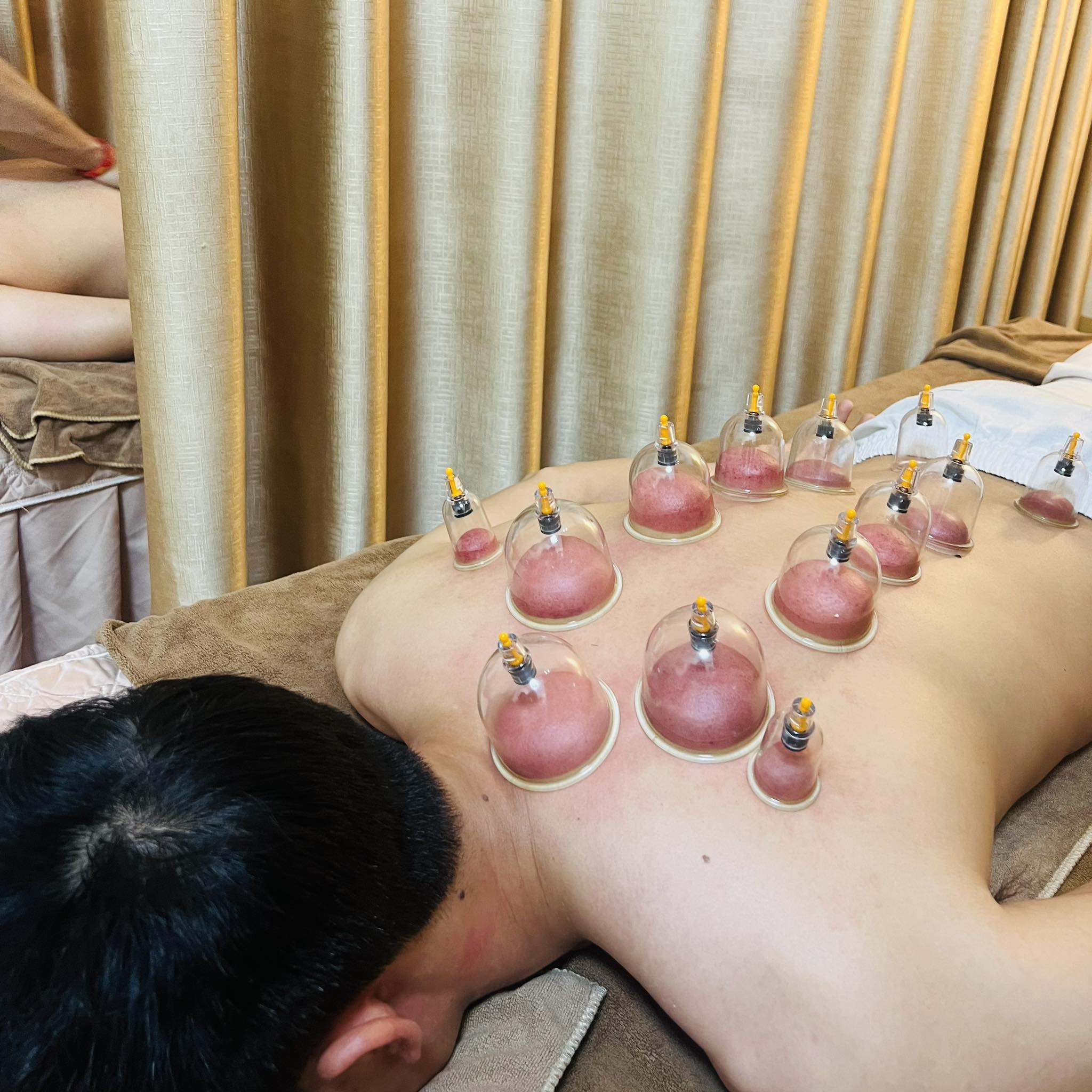 Giá dịch vụ giải cảm trừ phong theo y học cổ truyền